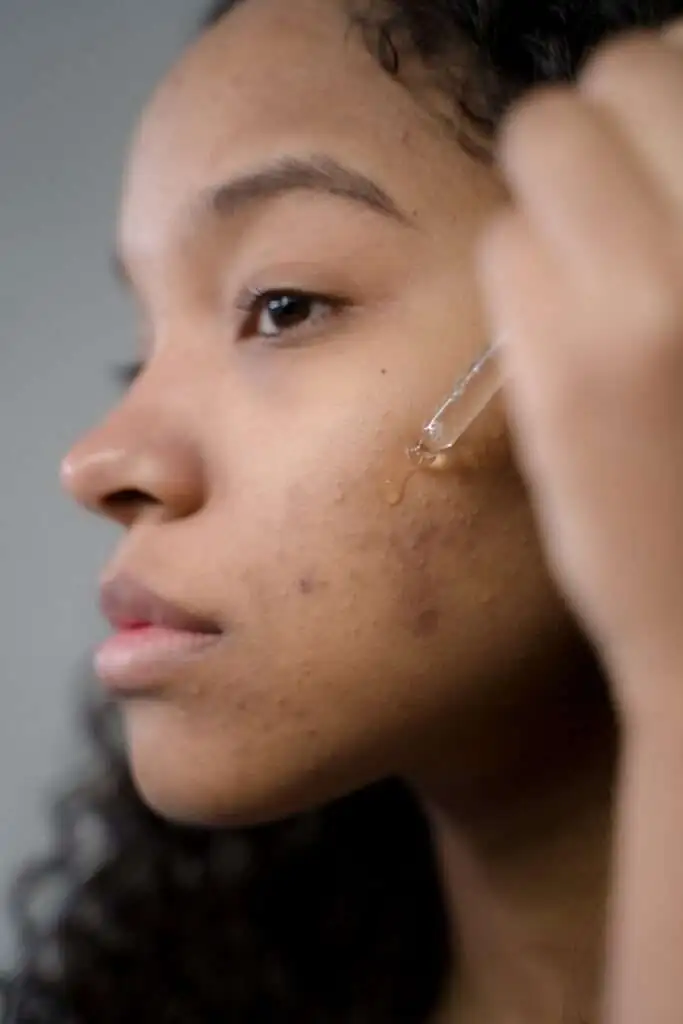Mastering Your Facial Acids Skincare Routine: Expert Tips for Glowing Skin